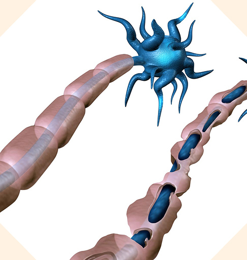 Mouse cuprizone model.