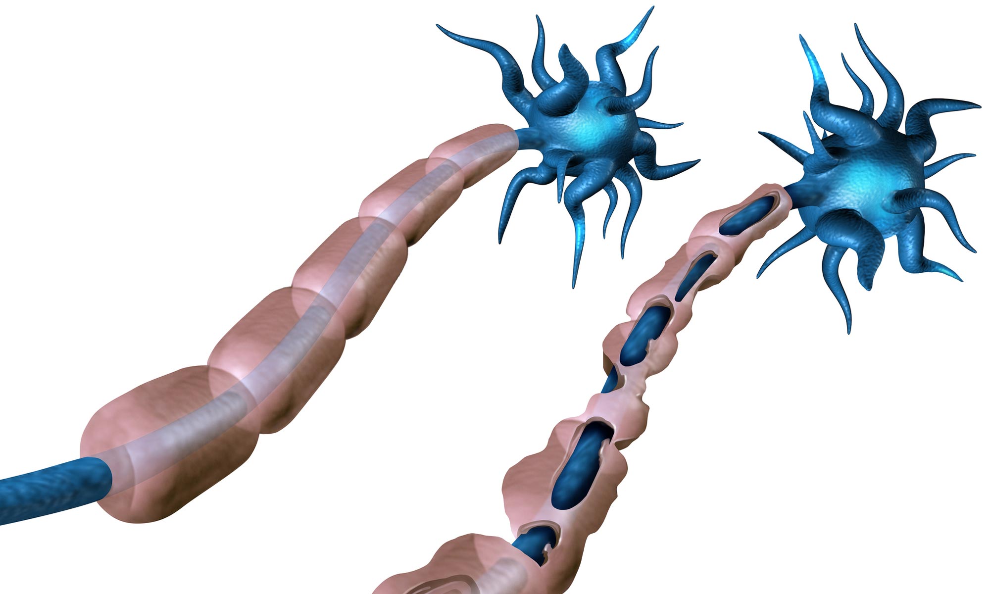 Experimental Autoimmune Encephalomyelitis (EAE)