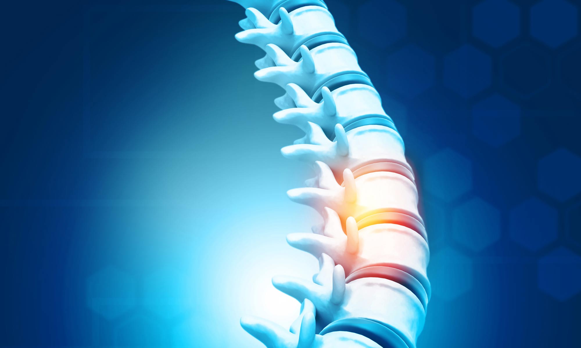 Spinal cord injury